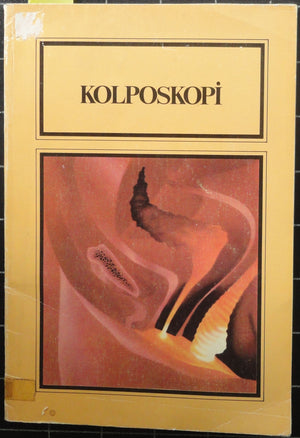 Kolposkopi